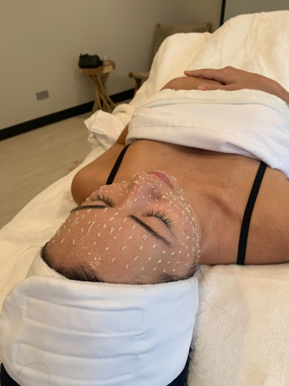 A photo of what happens during liquid microneedling with the application of microspears.