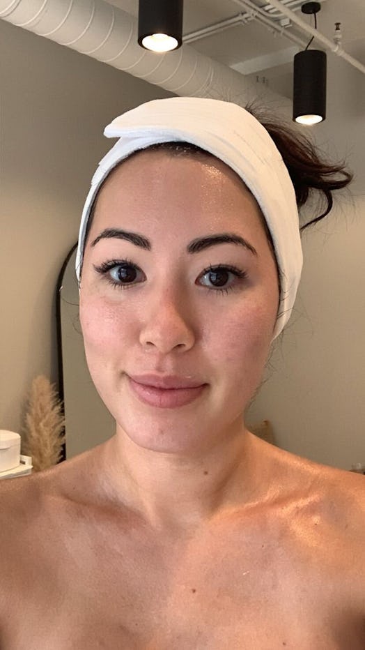 The writer trying liquid microneedling says she surprised her skin didn’t look red after the treatme...