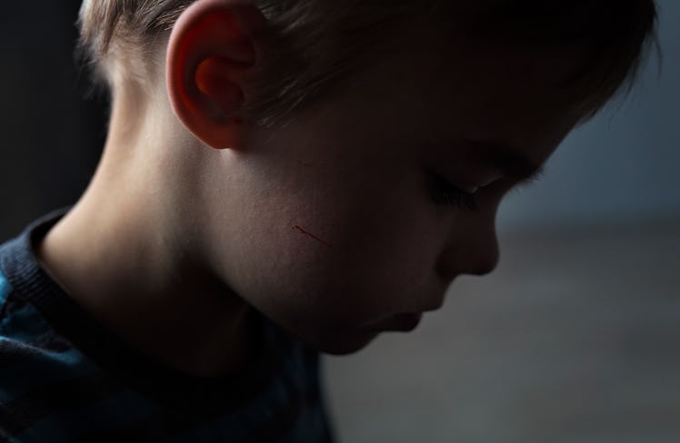 Close up of a sad child looking downward.