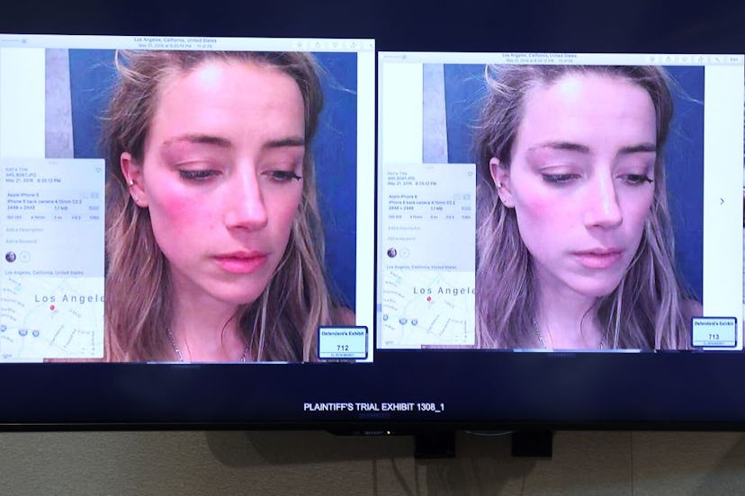 An evidence photo of Amber Heard appears on a screen at the Fairfax County Circuit Courthouse in Fai…
