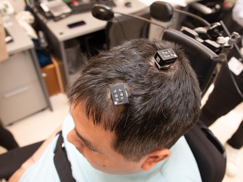 A man with ports installed in his head.