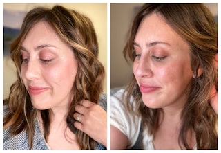 Writer Morgan Flaherty shows a before and after view of her face after fillers.