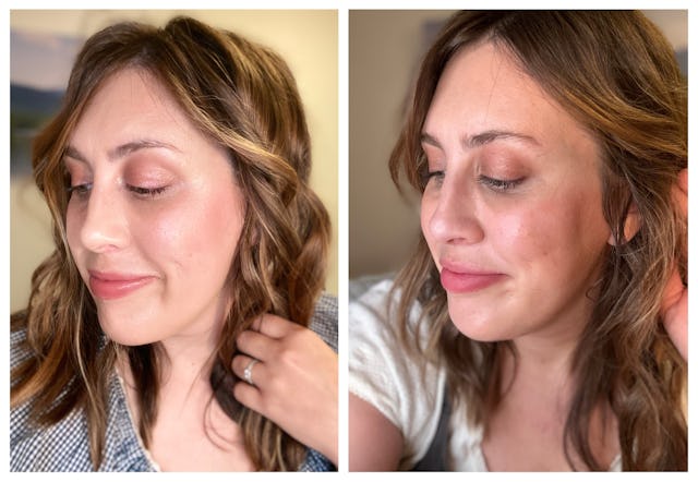 Writer Morgan Flaherty shows a before and after view of her face after fillers.