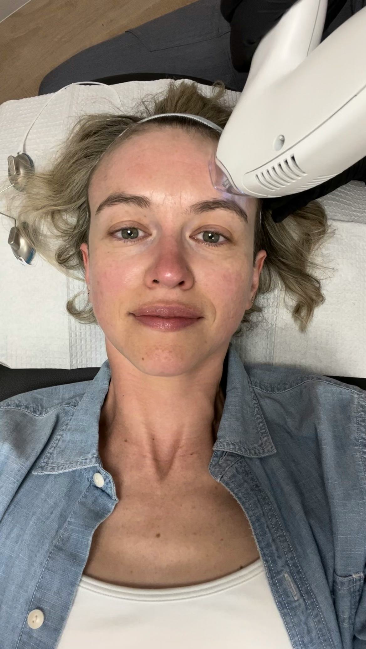 Skin Laundry The Fixer Review A NeedleFree Botox Alternative For