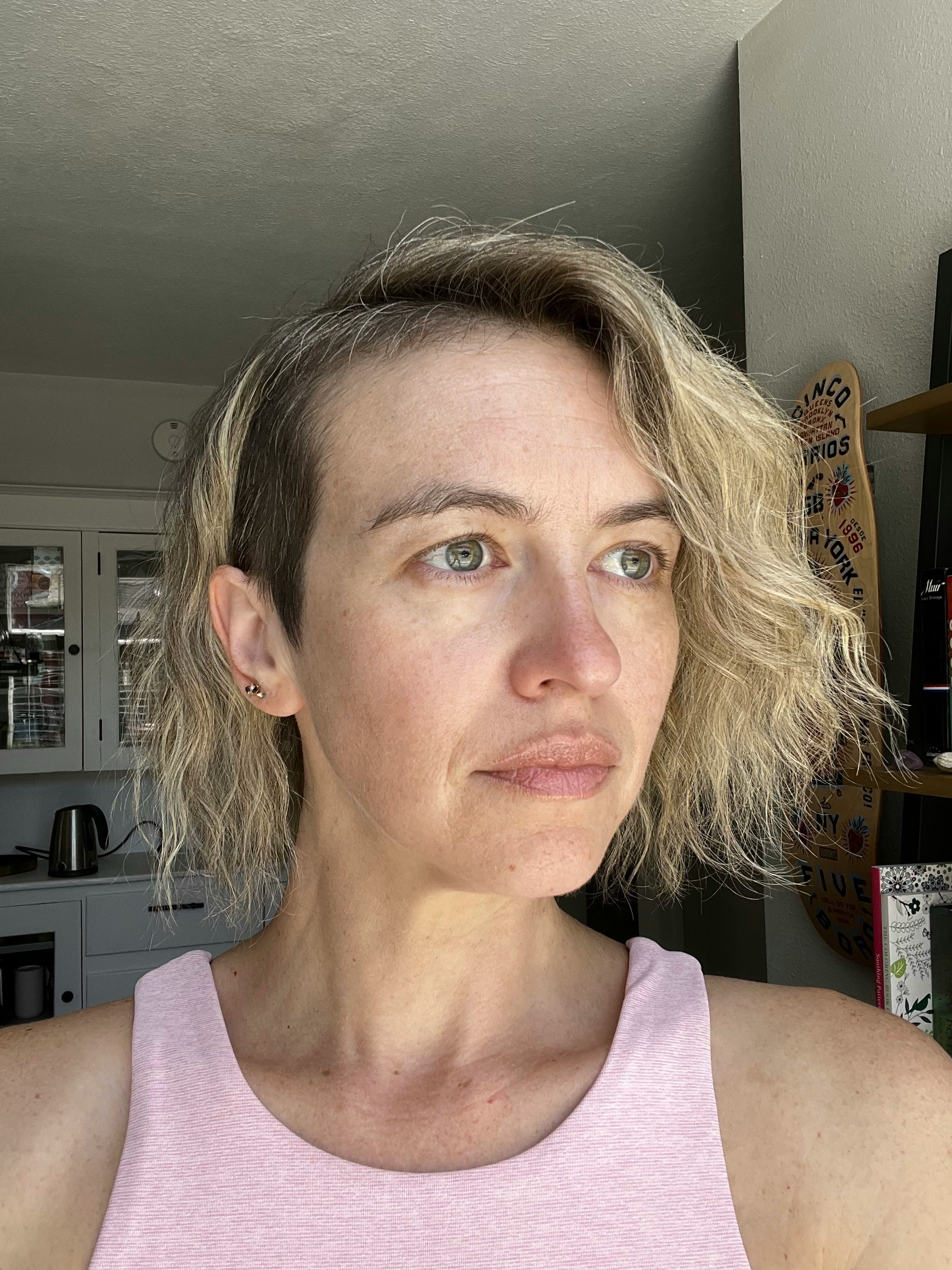 Skin Laundry The Fixer Review A NeedleFree Botox Alternative For