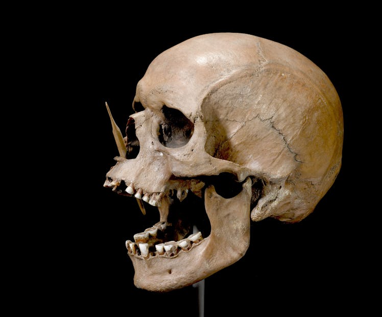 A human skull against a black backdrop. An arrow-like projectile protrudes into its mouth. 