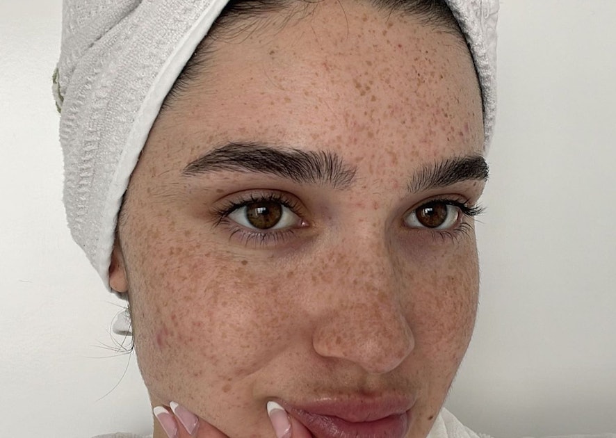 2024’s Biggest Skin Care Trends, According To Experts