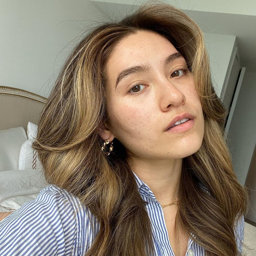 CO2 lift is an on-trend skin care treatment for 2024.