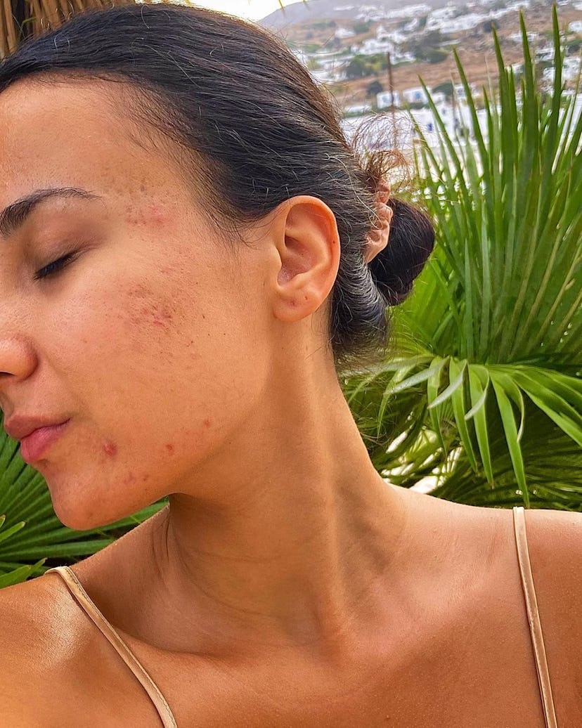 Skin inclusivity is a major skin care trend for 2024.