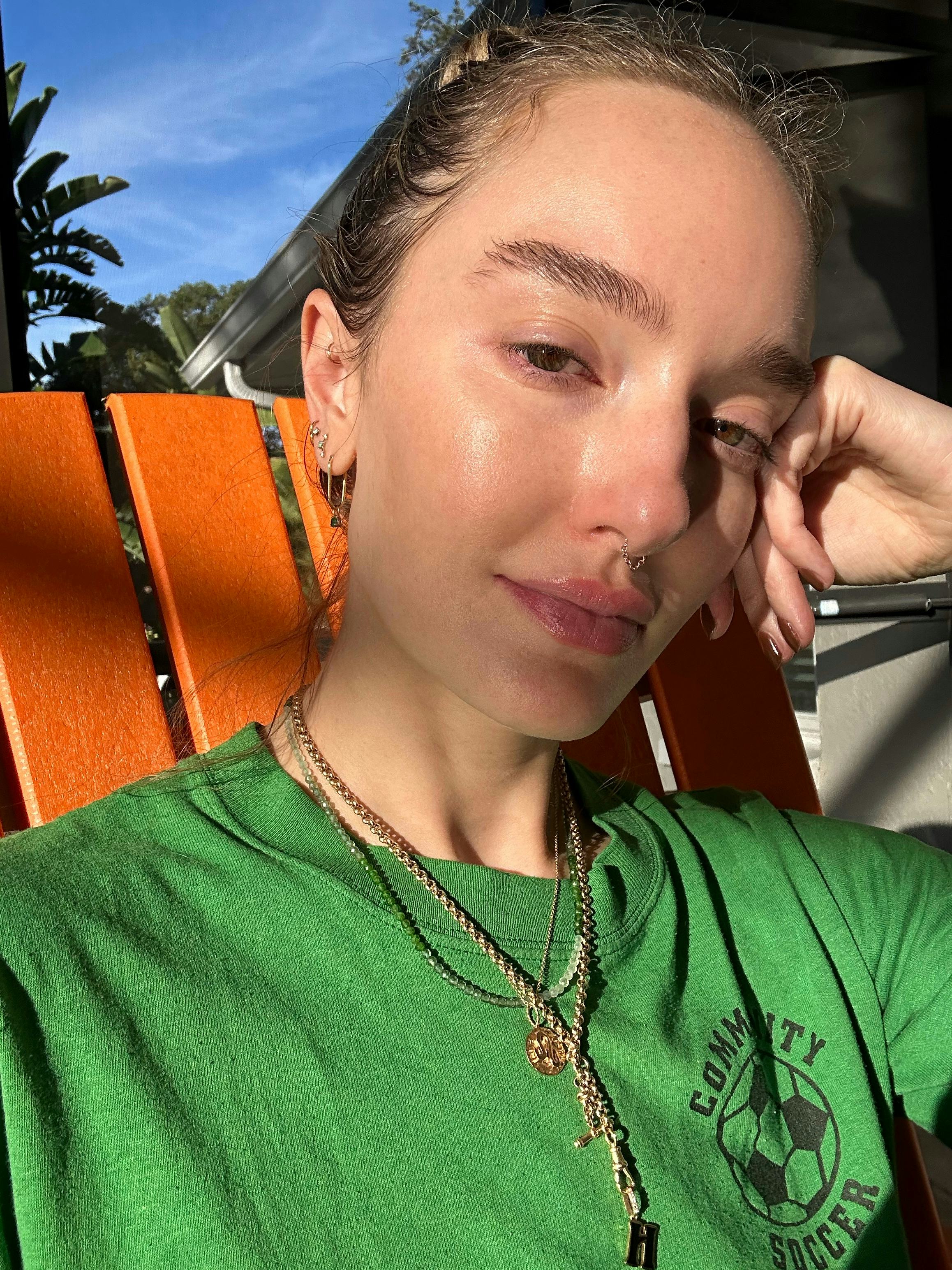 I tried a trichloroacetic acid peel for my melasma and my skin has never looked more even.