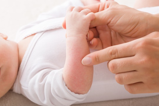 A mom rubs her index finger over her baby's forearm, where there is a red bumpy rash, in a story abo...