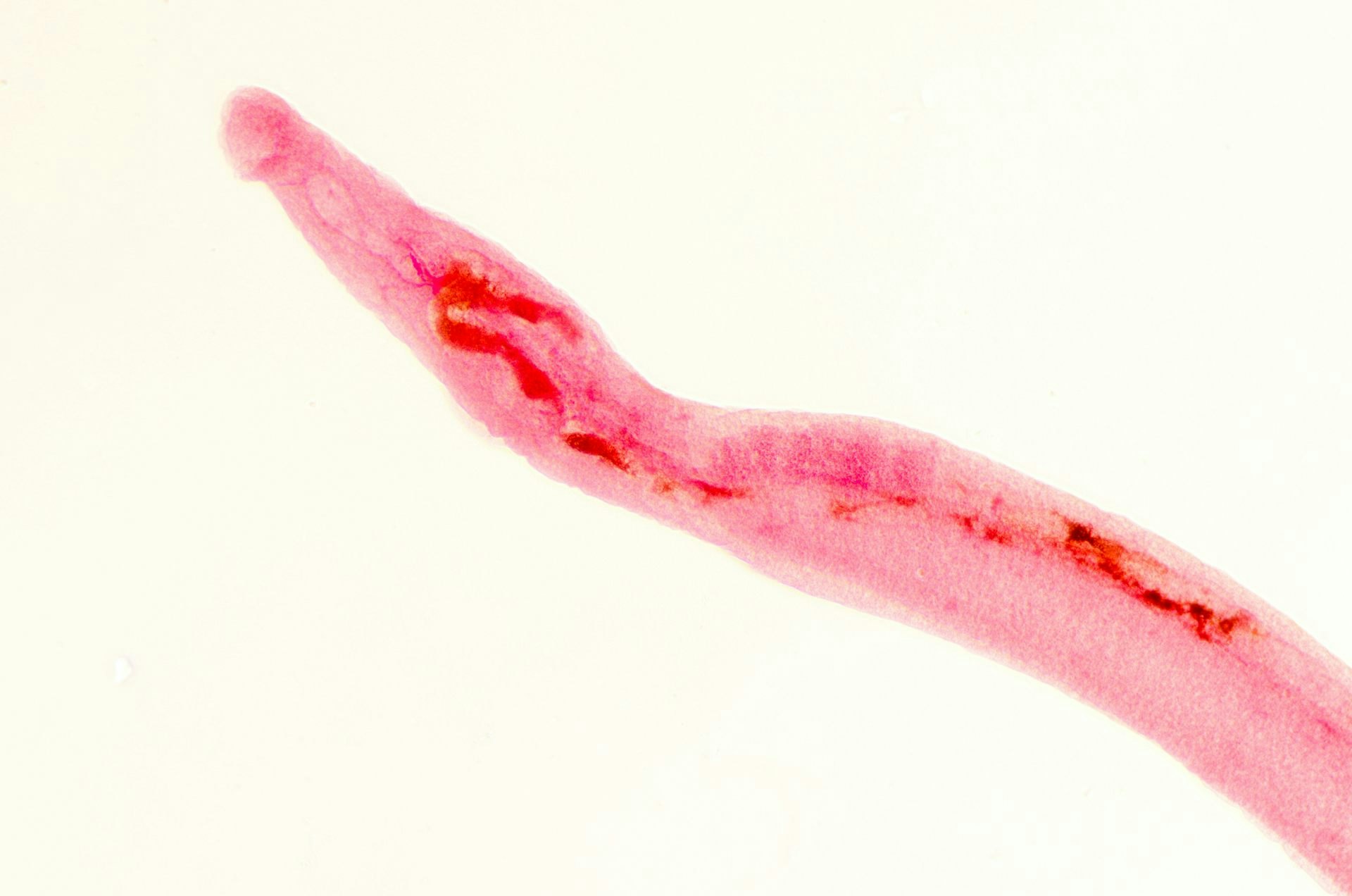 This Forgotten Parasite Is More Common Than You Think — Can AI Help Detect It?