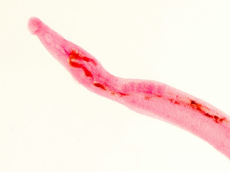 People often contract schistosomiasis through water contaminated with infected snails and feces.