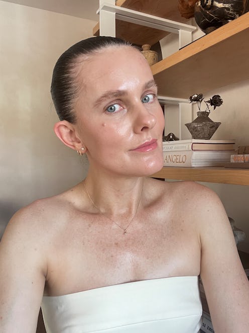 woman with thread lift