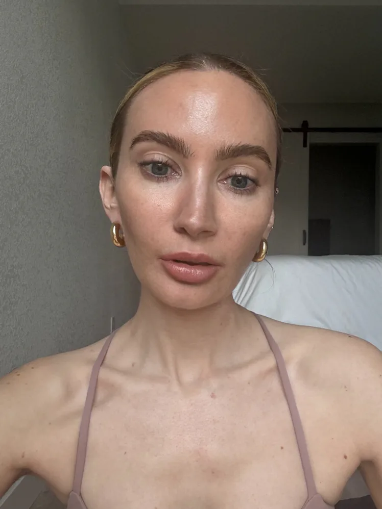 prx derm perfexion review