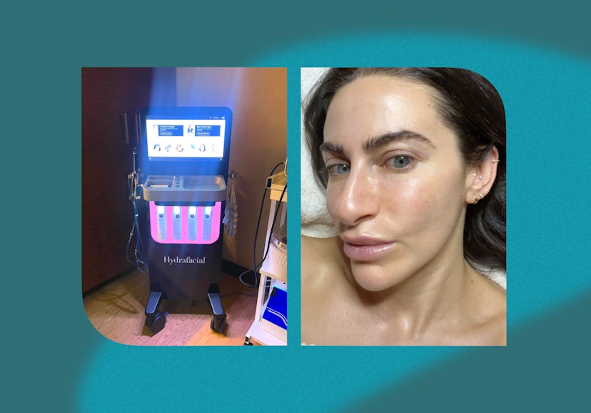 I tried HydraFacial's new Hydralock HA Booster and my skin has never looked better.
