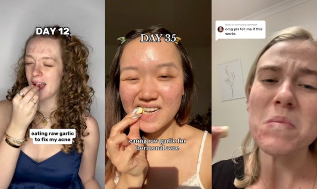 Screenshots of tik toks of young women eating raw cloves of garlic or rubbing it directly on breakou...