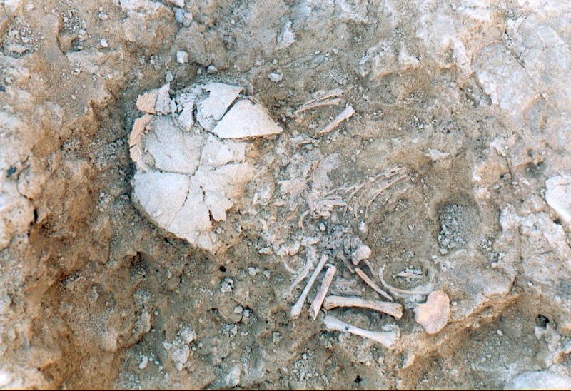 The inhumation of the prenatal infant with Down syndrome from the Iron Age site of Las Eretas. This ...