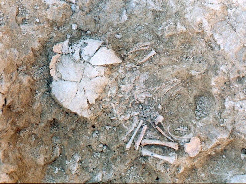 The inhumation of the prenatal infant with Down syndrome from the Iron Age site of Las Eretas. This ...