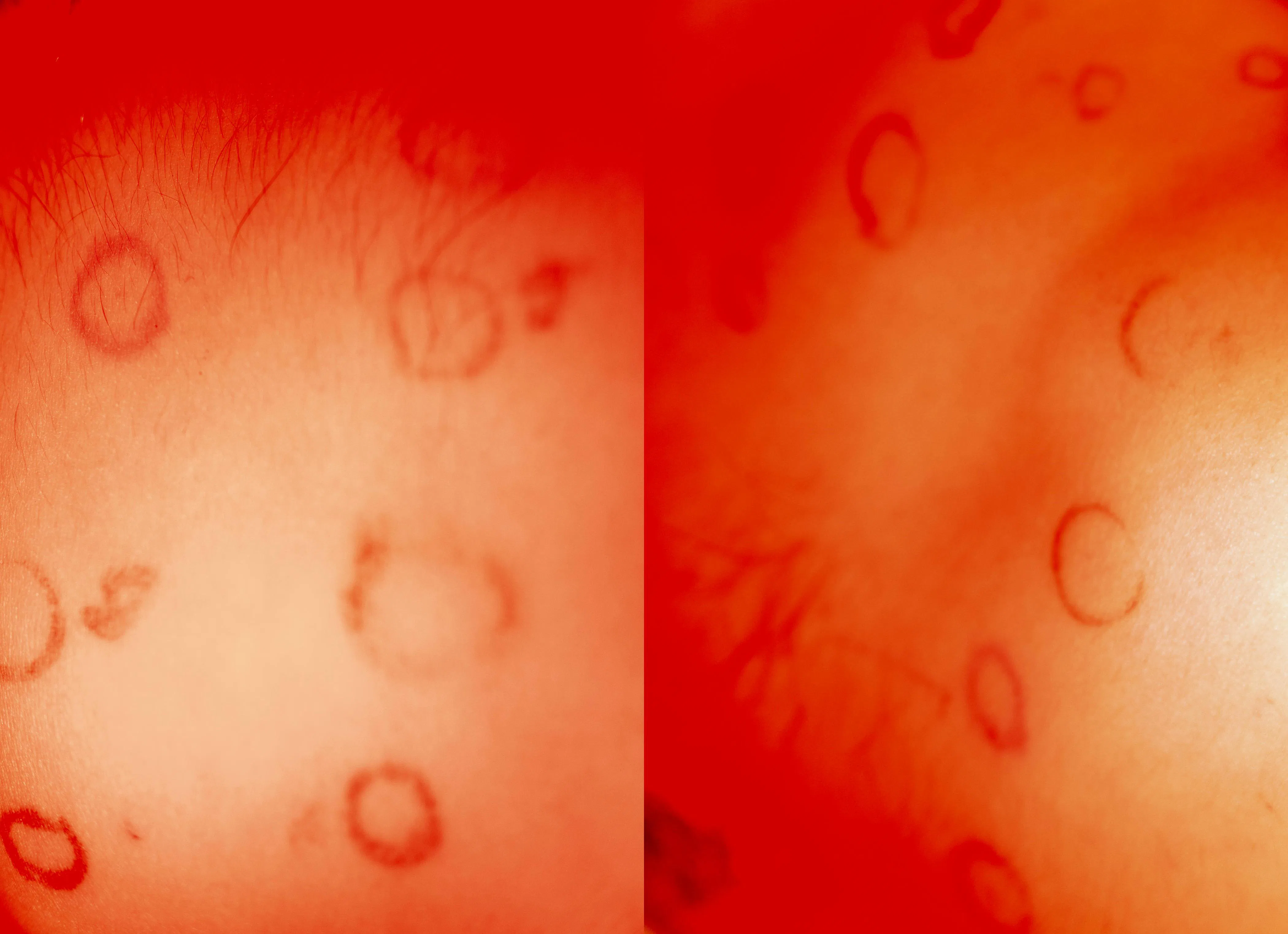 Frank Lebon’s ‘One Blood’ Photo Book Pairs Portraiture With Platelets