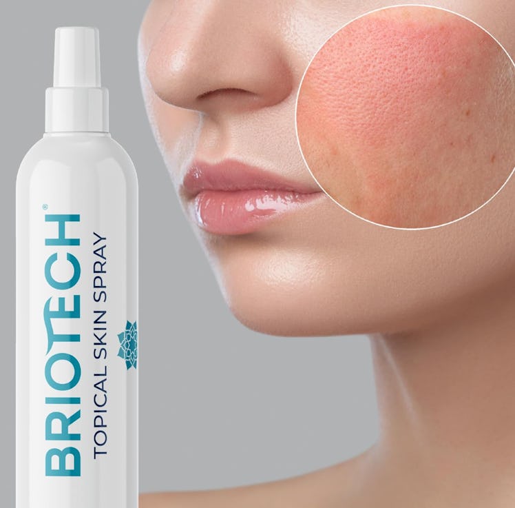 BRIOTECH Topical Skin Spray