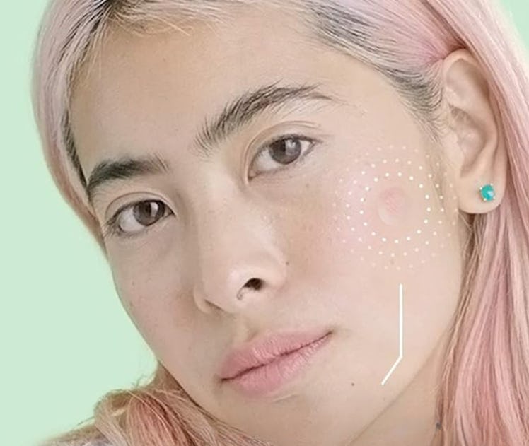 ZitSticka HYPERFADE Microdart Acne Patches (4-Pack)