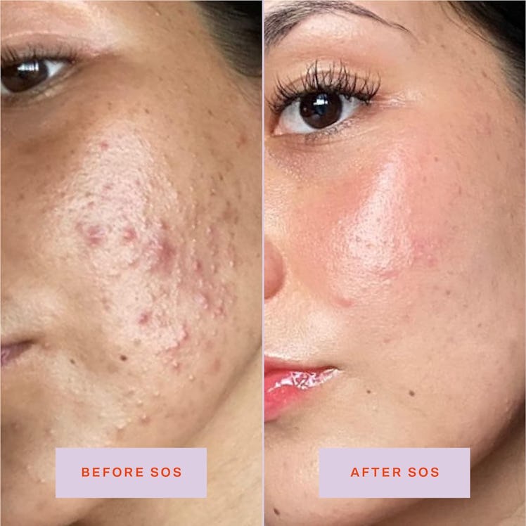 Tower 28 SOS Rescue Serum
