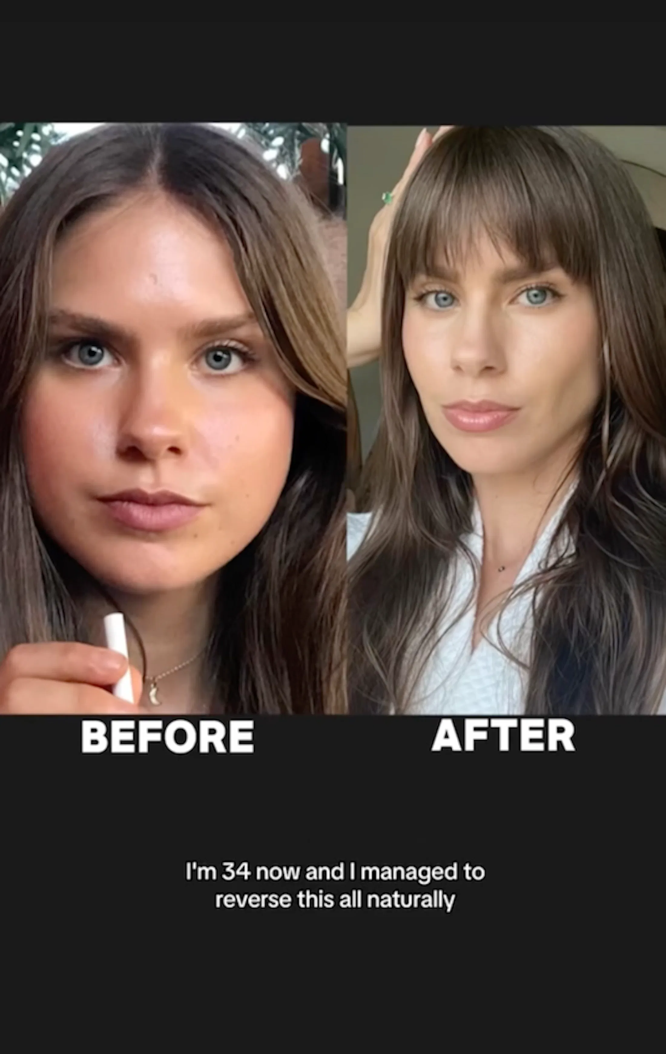 What Is Cortisol Face A Side Effect Caused By Stress What is cortisol face a side effect caused by stress