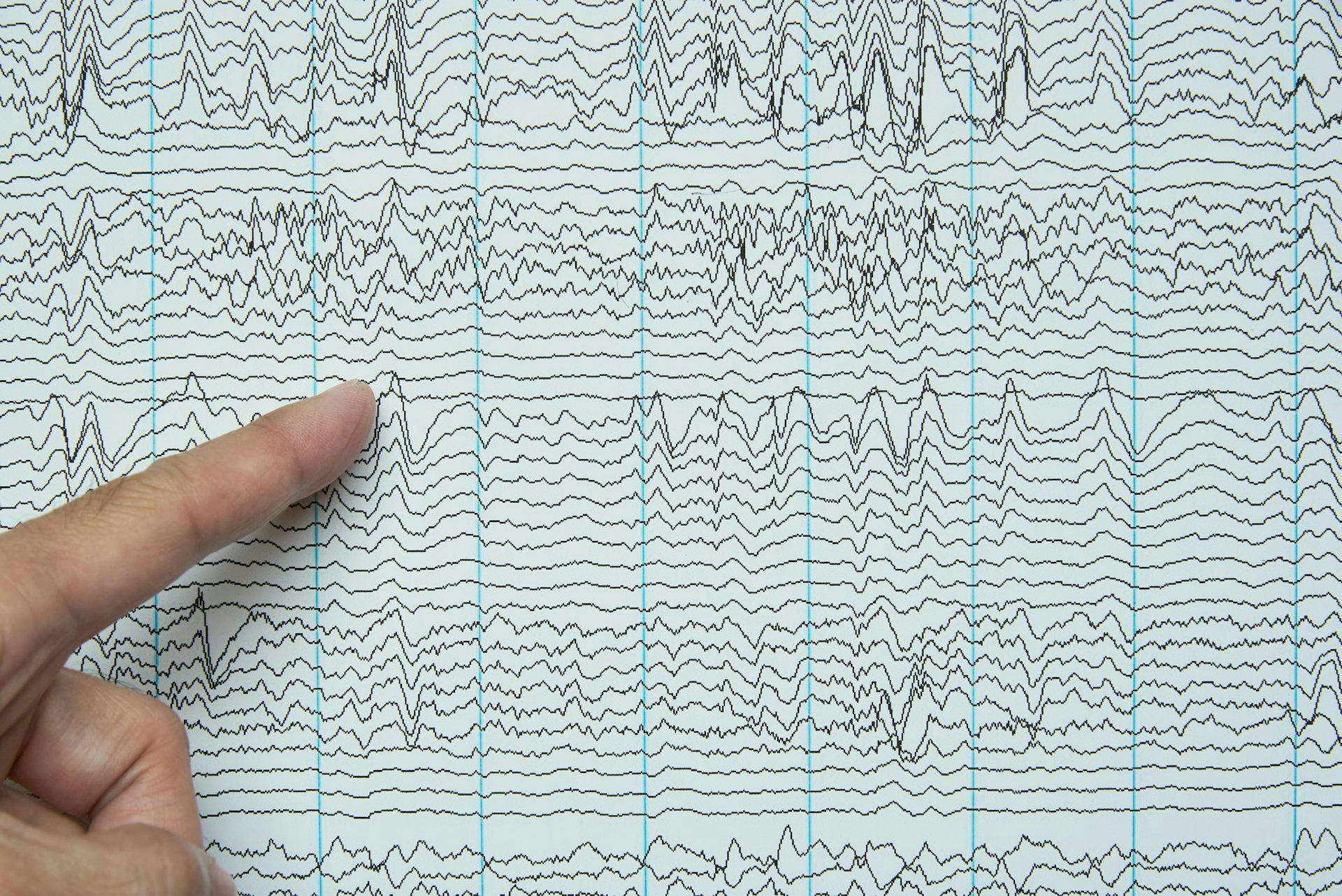 This Relatively Simple Device Completely Transformed Neuroscience