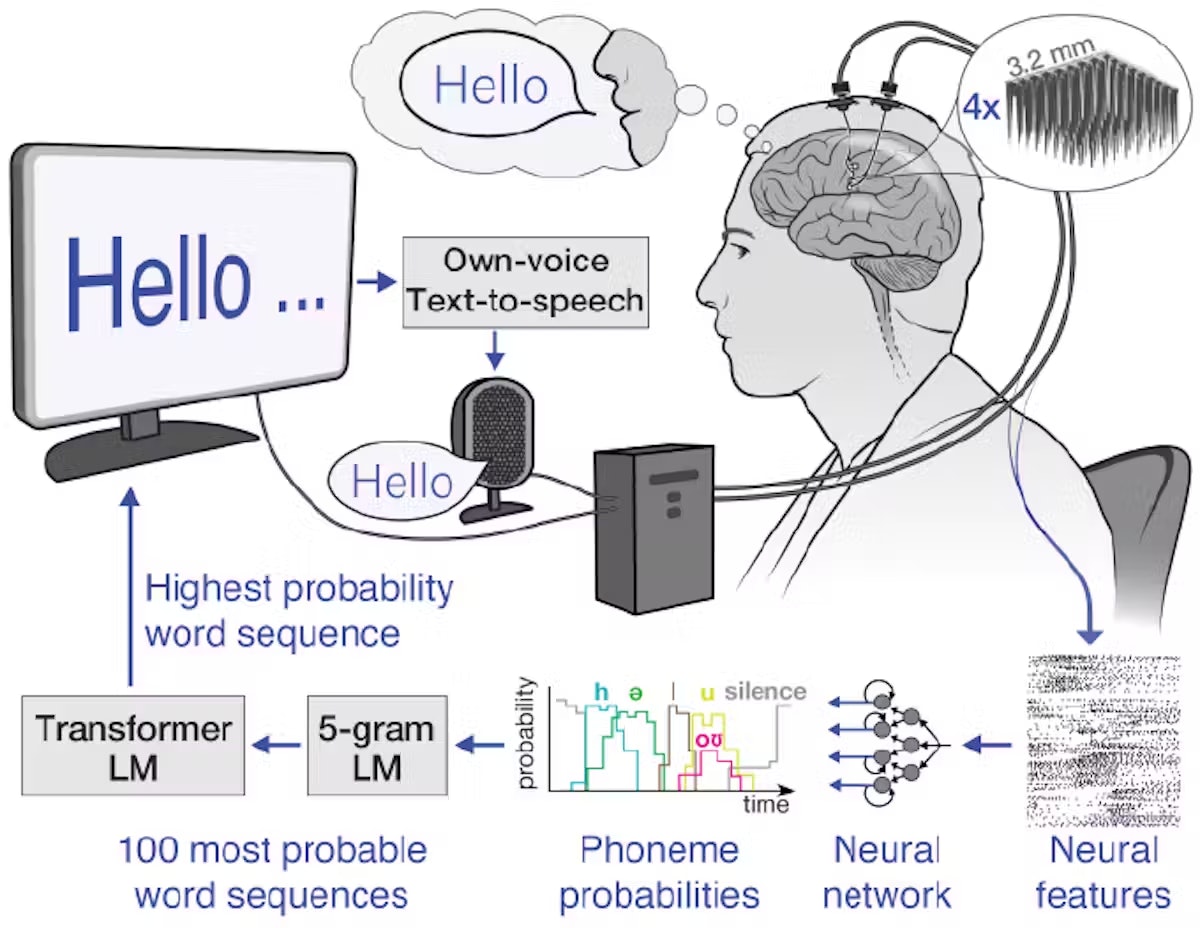 Brain-Computer Interfaces Could Get A Significant Boost From AI