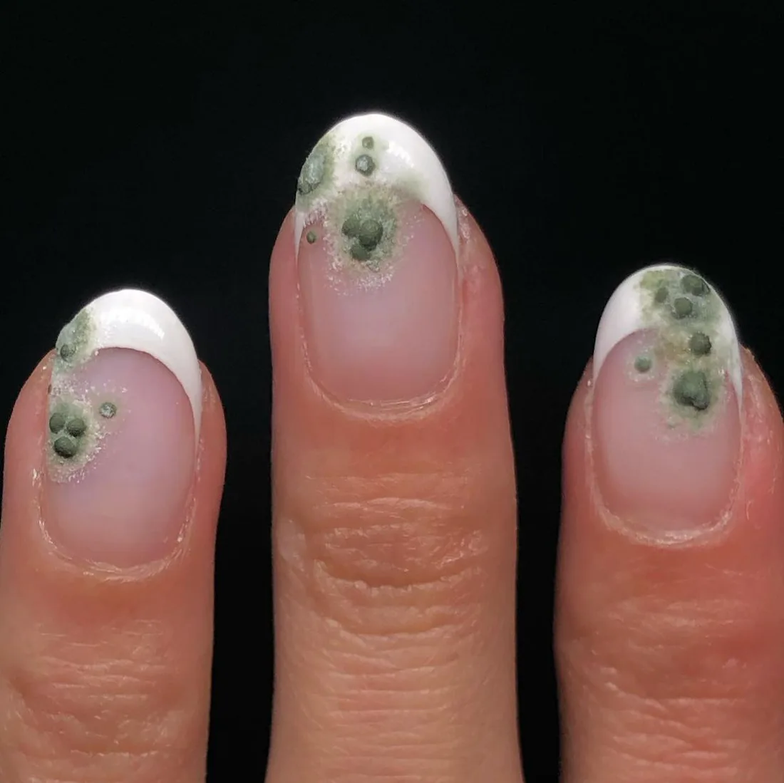 Nails Discusting Hyper-Realistic Nail Art Is Trending & It’s Utterly Disgusting