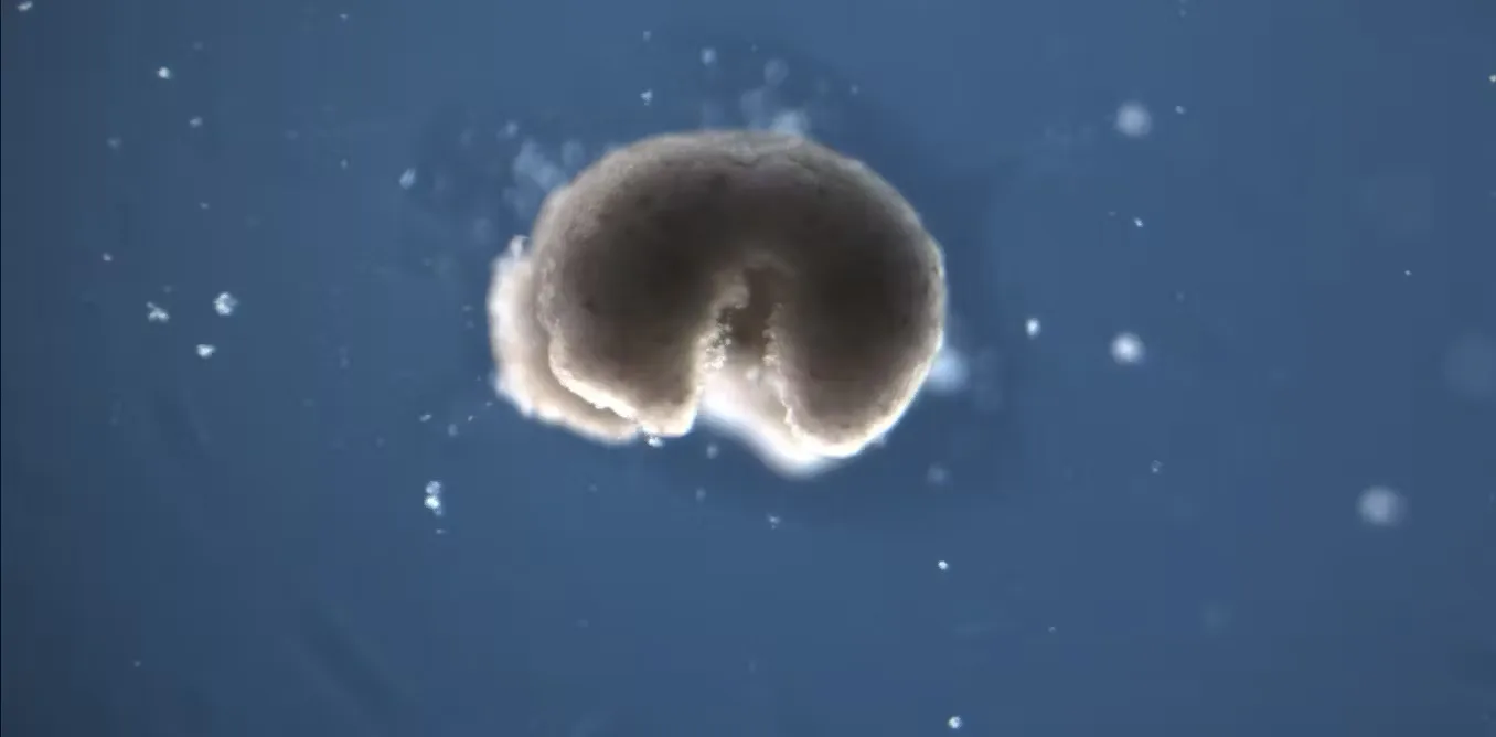 Researchers Study Life After Death And It Gets Weirder