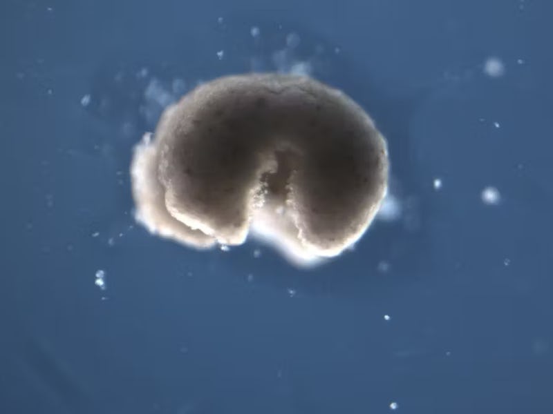 Biobots could one day be engineered to deliver drugs and clear up arterial plaque