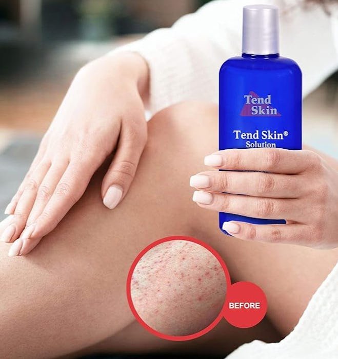 Tend Skin Ingrown Hair Solution