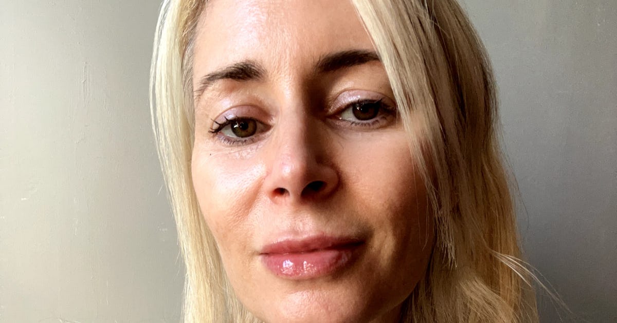 I Got Evolysse Lip Filler & Love My Subtle, Natural Results