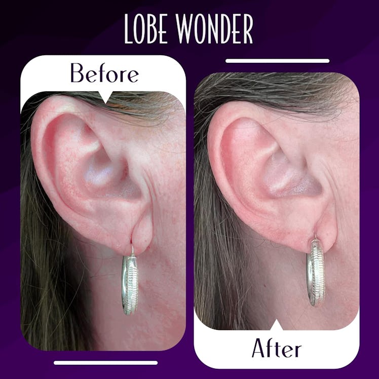 Lobe Wonder Ear Lobe Support Patch (60 Patches)