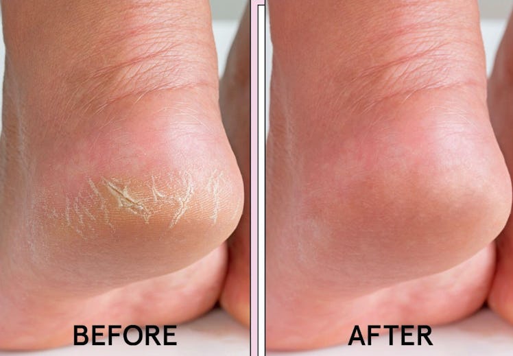 grace & stella Foot Peel Mask (4 Pairs)