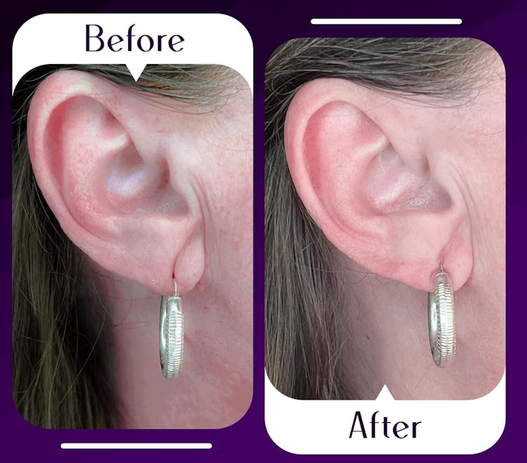 Lobe Wonder Ear Support Patches (60-Pack)