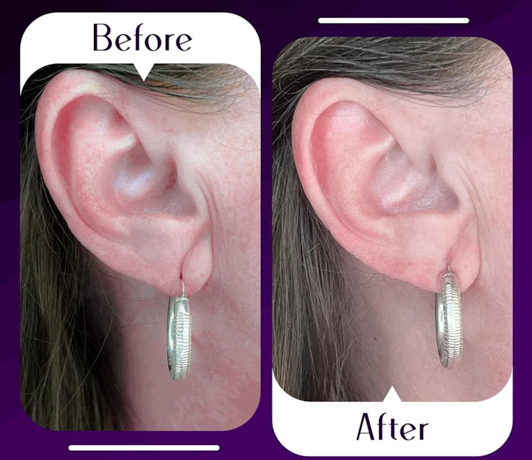 Lobe Wonder Ear Lobe Support Patch (60 Pieces)