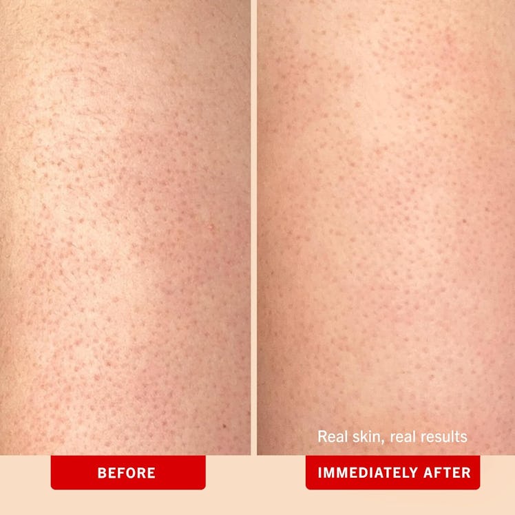 First Aid Beauty KP Bump Eraser Body Scrub