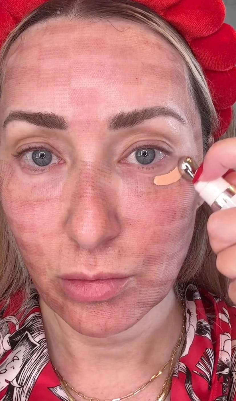 co2 resurfacing laser treatment