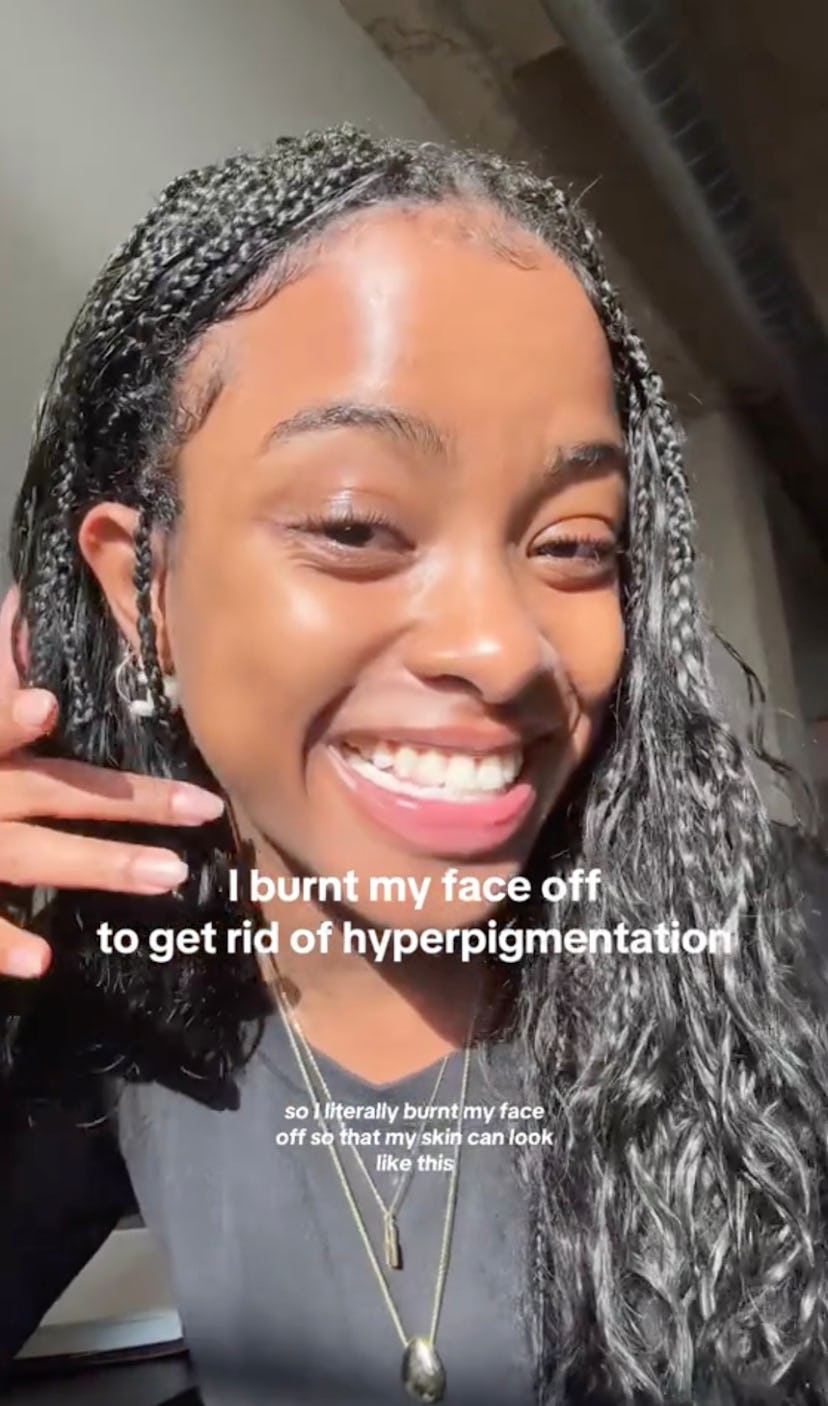 do you need a yearly skin reset