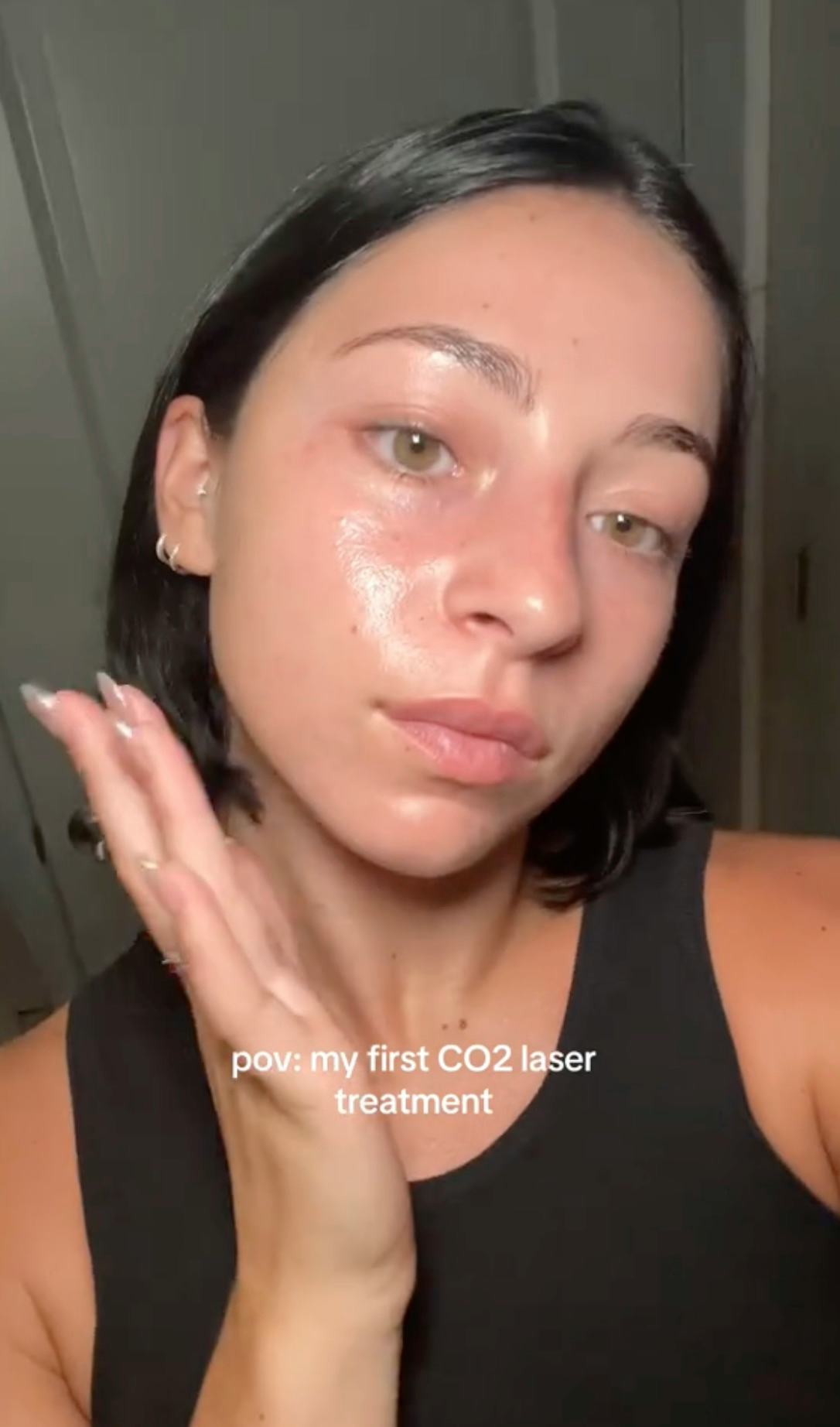 skin reset