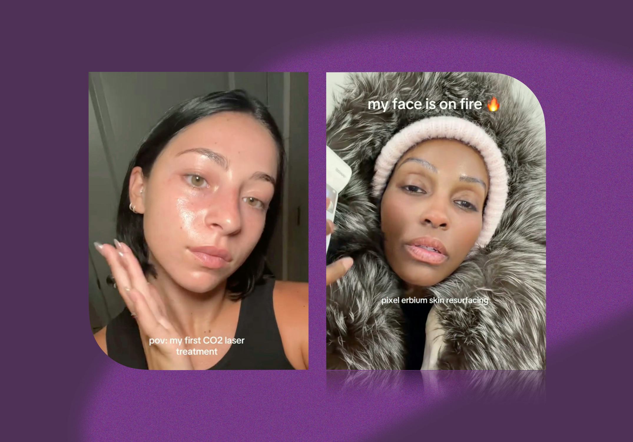 A dermatologist weighs in on the yearly skin reset trend going viral on TikTok.
