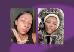 A dermatologist weighs in on the yearly skin reset trend going viral on TikTok.
