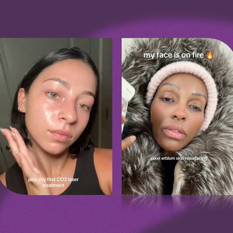A dermatologist weighs in on the yearly skin reset trend going viral on TikTok.