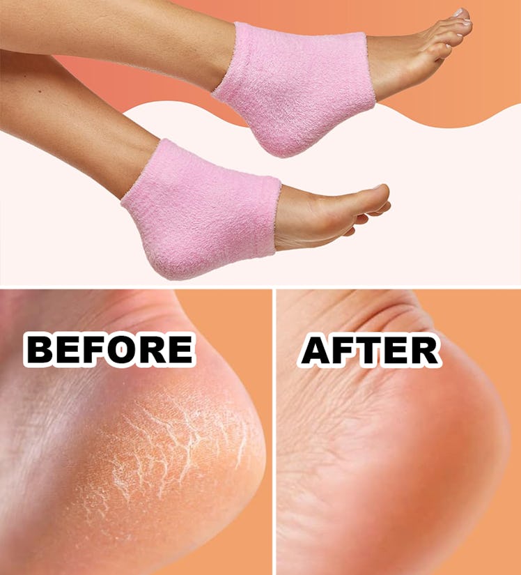 ZenToes Moisturizing Sleep Socks with Vitamin E