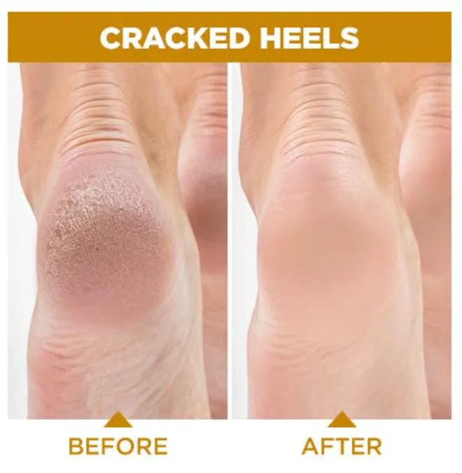 Lavinso Honey Feet Peeling Mask (2-Pack)