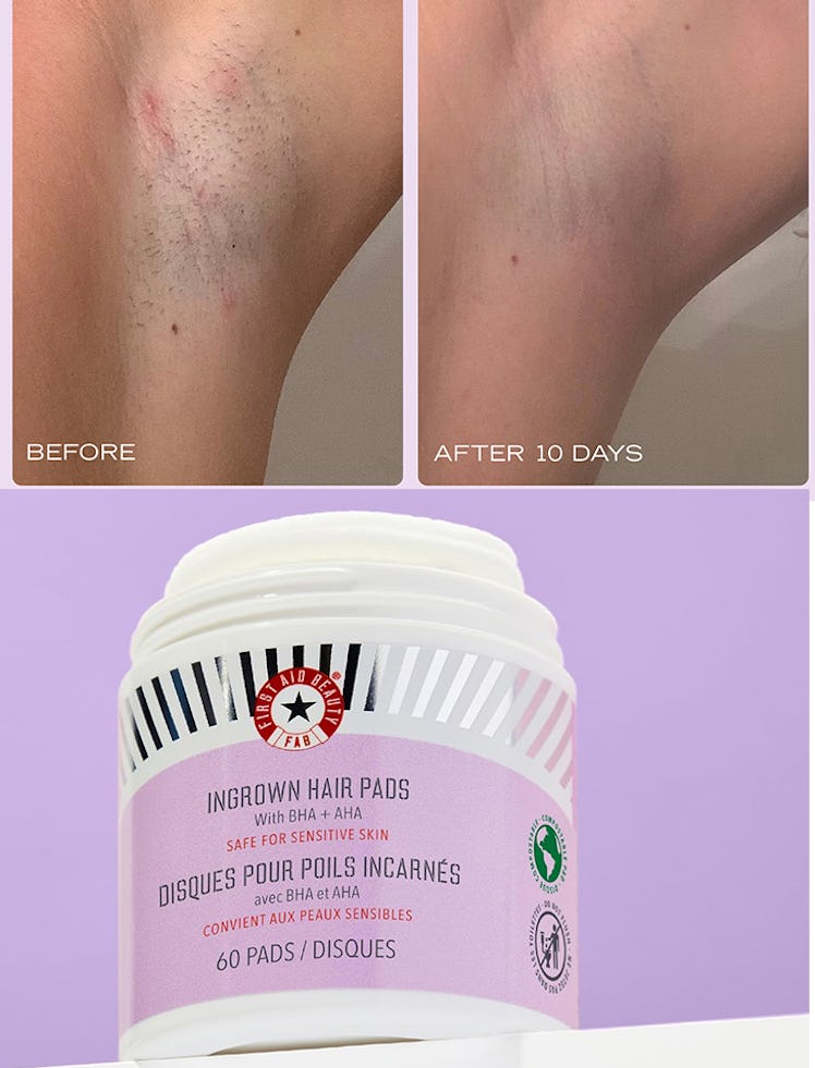 First Aid Beauty Ingrown Hair Pads (28-Pack)