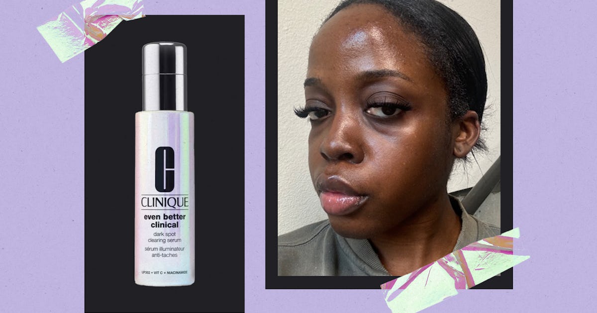 I Tested Clinique's Clinical Dark Spot Serum & It's Really That Good